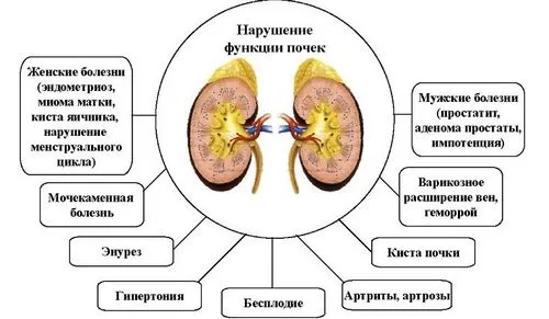 як лікувати нирки у жінок
