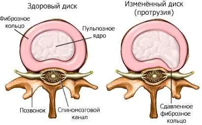 чи можна лікувати шию