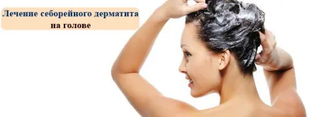 дерматит себорейний лікування на обличчі