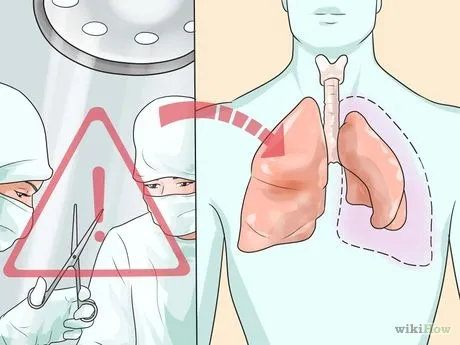 Як лікувати пневмонію як лікувати запалення легенів