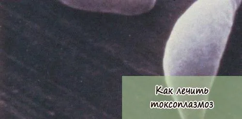 токсоплазмоз лікувати чи ні
