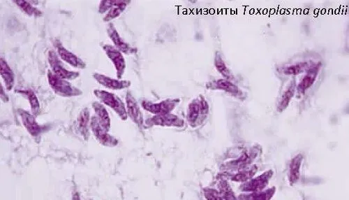 токсоплазмоз лікувати чи ні