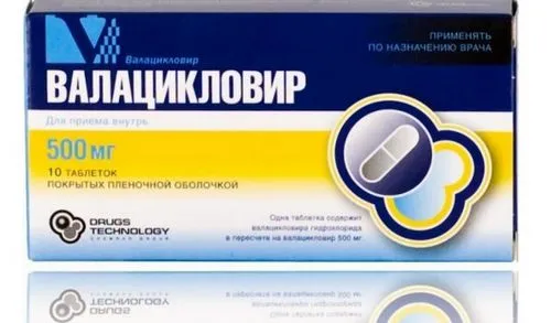 лікування вітрянки