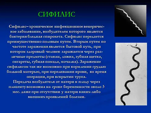 як розпізнати сифіліс