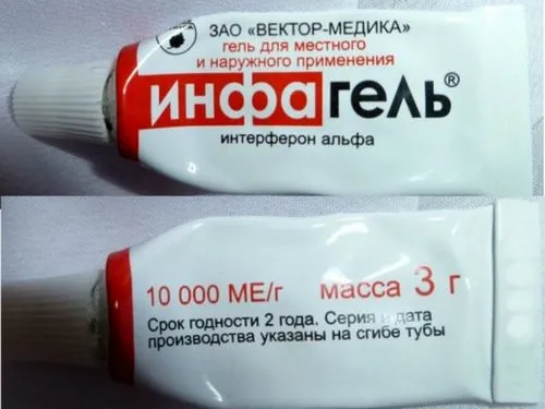 лікування вітрянки