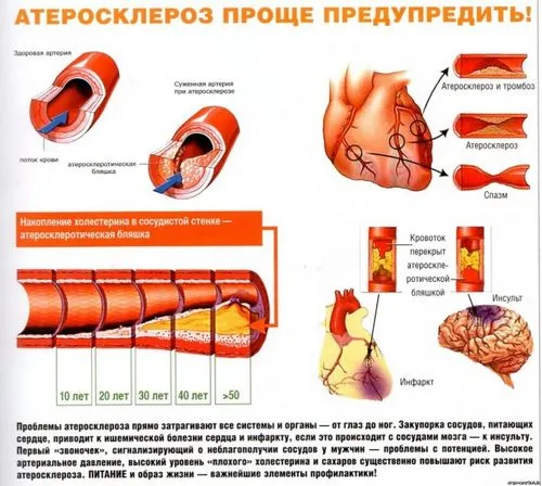 як лікувати хворобу ніг
