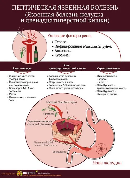 як лікувати шлунок виразка