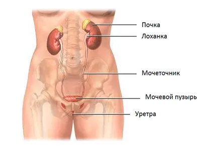 як лікувати кісту сечового міхура