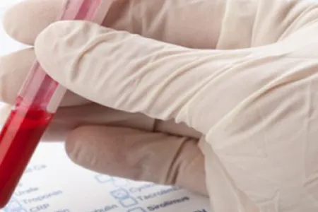 як лікувати камені в жовчних протоках