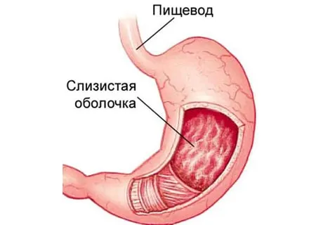 як вилікувати хронічний гастрит лікувати чи можна лікування симптоми у дорослих
