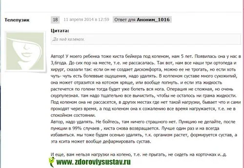 як лікувати кісту Бейкера без операції