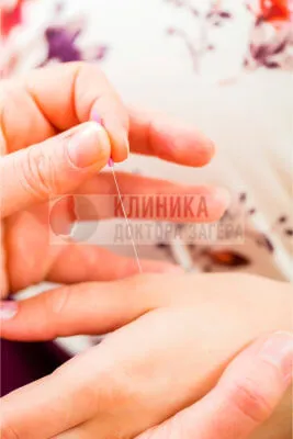 чи можна вилікувати безпліддя гомеопатією
