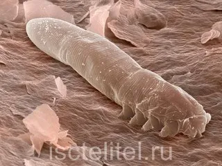 як лікувати демодекоз особи народними засобами