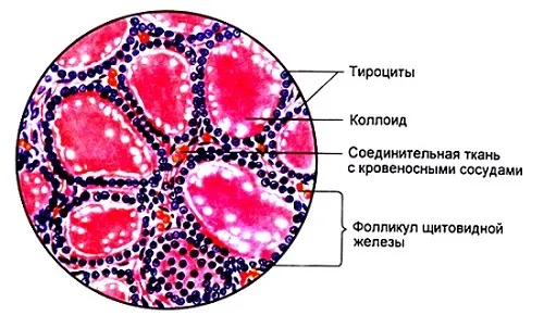 як лікувати колоїдний зоб