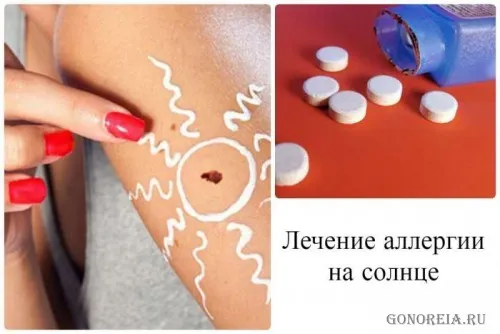 лікувати алергію на сонце