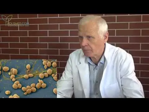 як лікувати жіночий кандидоз