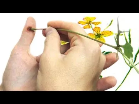 як лікувати печінку чистотілом