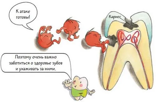 лікування карієсу молочних зубів