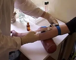 нове в лікуванні ВІЛ