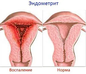 як лікувати мастит у корови