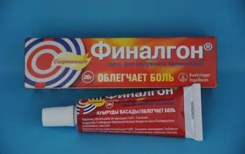 як лікувати радикуліт мазь