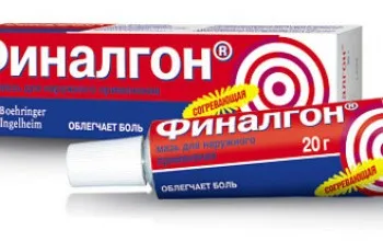 як лікувати радикуліт мазь