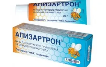 як лікувати радикуліт мазь