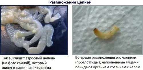 як лікувати глисти у людини