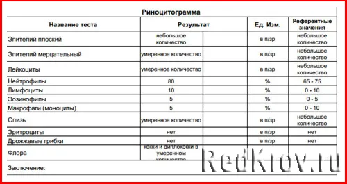 хронічний еозинофільний риніт