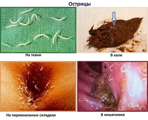 як лікувати глисти у людини