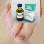 чи можна лікувати отит перекисом водню