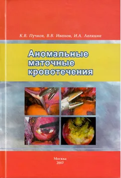 як лікувати ендометріоз медикаментозно