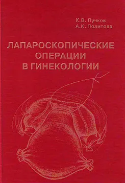 як лікувати ендометріоз медикаментозно