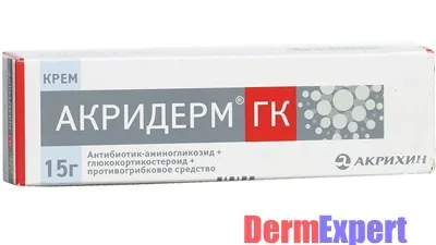 псоріаз