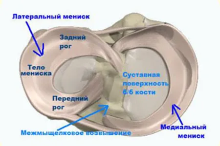 менісціт колінний суглоб лікування