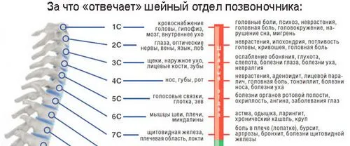 Остеохондроз: причини, симптоми і ознаки як лікувати остеохондроз у дітей