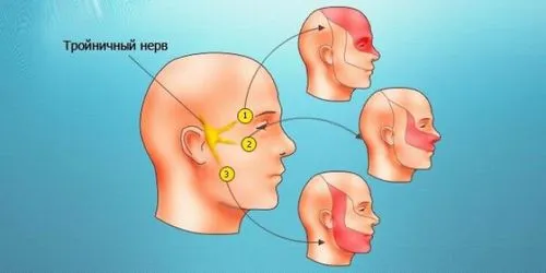 як лікувати зубний невралгію