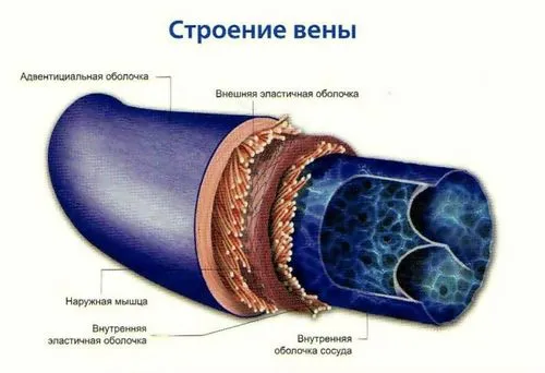 Від чого з'являється варикоз від чого з'являється варикоз