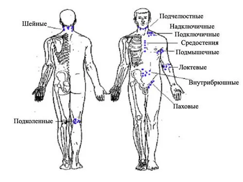 запалення шиї