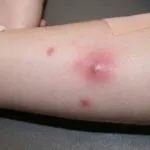 морфологічні елементи