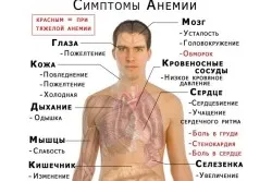 як лікувати пернициозную анемію