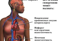 як лікувати нирки при гіпертонії