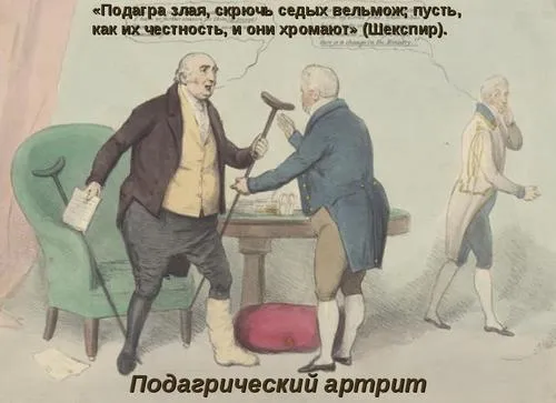 як лікувати подагричний артрит