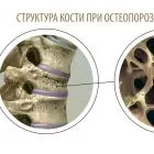 здоров'я