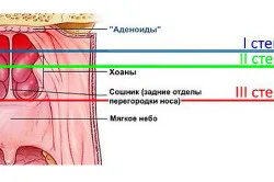 здорове горло