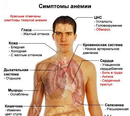 ознаки та лікування залізодефіцитної анемії народними засобами
