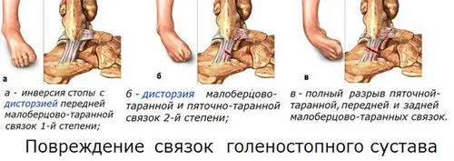 реабілітація