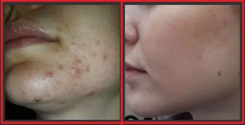 протирання