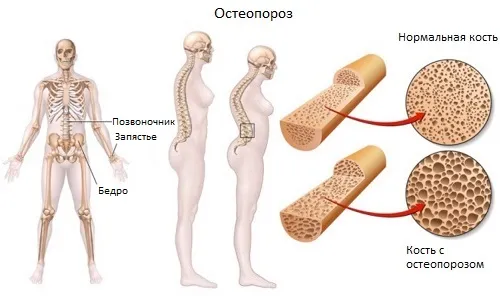 лікувати болять суглоби
