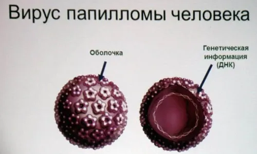 як лікувати бородавки у роті